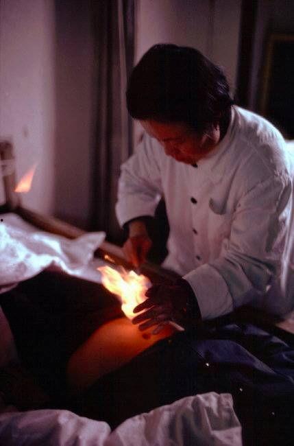 老中医做针灸视频爆料  第1张